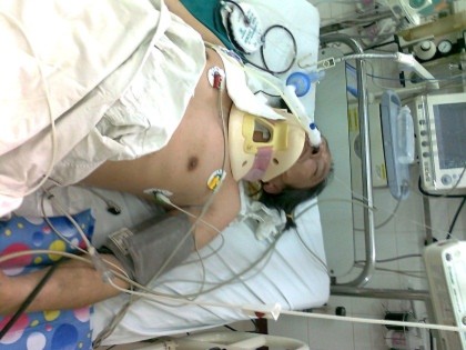 Sau 6 ngày thở máy, công dân Trịnh Xuân Tùng đã tử vong vì bị đánh gãy cổ