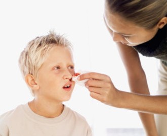 Làm gì khi bị chảy máu cam?