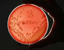 'Siêu vi khuẩn' kháng thuốc đã có tại Việt Nam