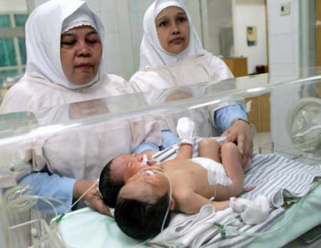 Em bé hai đầu ở Ai Cập, Phi thường - kỳ quặc, em bé,hai đầu,chuyện lạ
