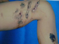 Bảo vệ thả chó béc giê tấn công trẻ em dã man