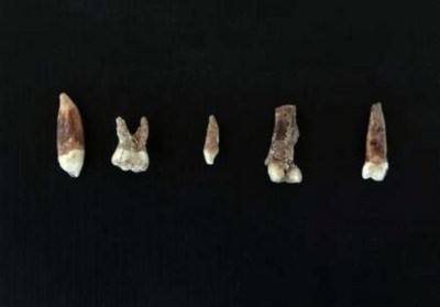Phát hiện chiếc răng người 400.000 năm tuổi