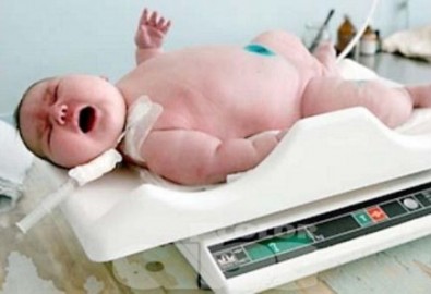Bé sơ sinh nặng 7,2kg chào đời ở Nga