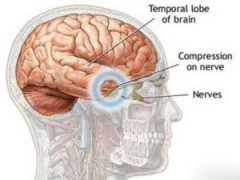 Não người ngày càng nhỏ đi