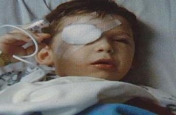 Bác sĩ mổ nhầm mắt cho cậu bé 4 tuổi