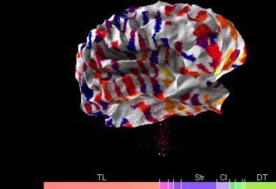 Tiết lộ bản đồ não người đầu tiên của thế giới