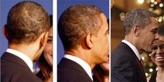 Vết sẹo lạ trên đầu Obama
