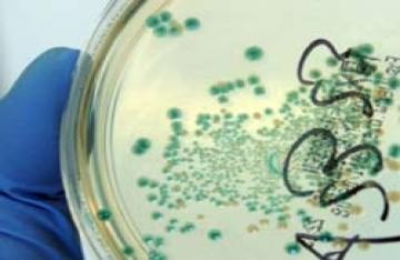 Khuẩn E.coli gây tử vong ở châu Âu là chủng mới, cực độc