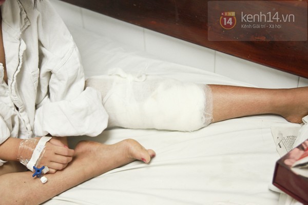 Thương bé gái sống chung với cái chân lúc nhúc giòi suốt gần 3 năm 3 Thương bé gái sống chung với cái chân lúc nhúc giòi suốt gần 3 năm 3