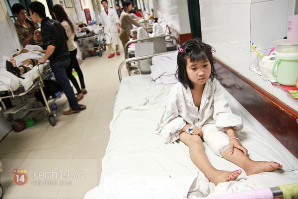 Thương bé gái sống chung với cái chân lúc nhúc giòi suốt gần 3 năm 4 Thương bé gái sống chung với cái chân lúc nhúc giòi suốt gần 3 năm 4