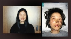Chị Cao Dung Dung trước và sau khi bị tra tấn bằng dùi cui điện