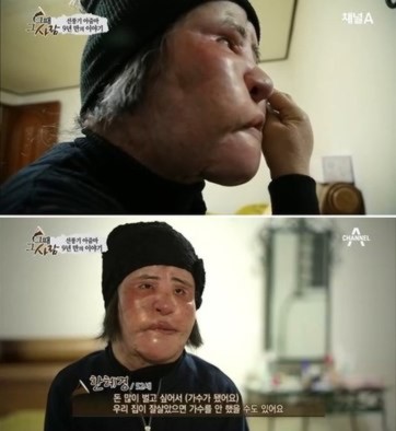 Cuộc sống cô đơn của "Thảm họa thẩm mỹ" xứ Hàn 1