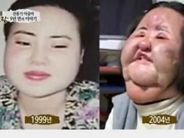 Cuộc sống cô đơn của "Thảm họa thẩm mỹ" xứ Hàn 2 Cuộc sống cô đơn của "Thảm họa thẩm mỹ" xứ Hàn 2