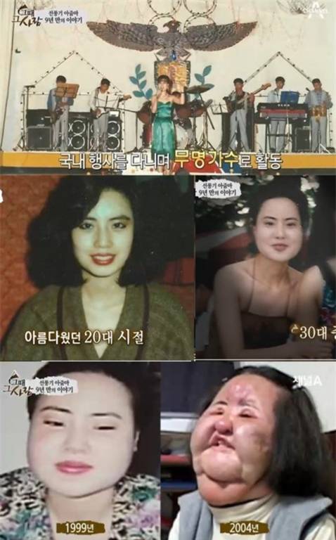 Cuộc sống cô đơn của "Thảm họa thẩm mỹ" xứ Hàn 3