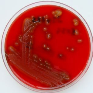Vi khuẩn ăn thịt người tiến hóa cực nhanh