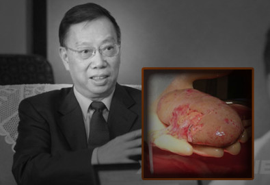 Dưới làn sóng lên án cự đại của cộng đồng quốc tế, Hoàng Khiết Phu, cựu phó bộ trưởng Bộ y tế Trung Quốc đã nhiều lần ra mặt biện hộ.Ảnh internet