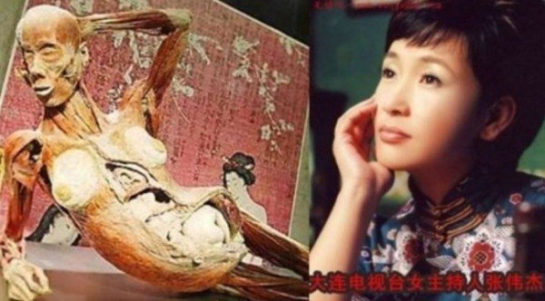 Bộ xương người có nhiều nét giống nữ MC Trương Vĩ Kiệt