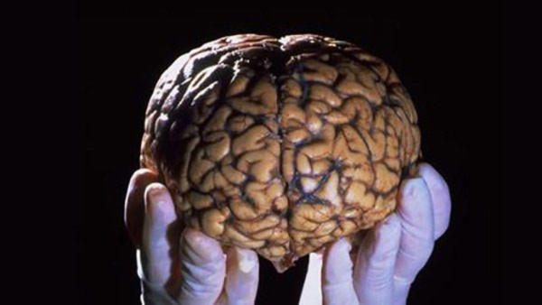 Con người hoạt động thế nào nếu chỉ còn nửa bộ não?