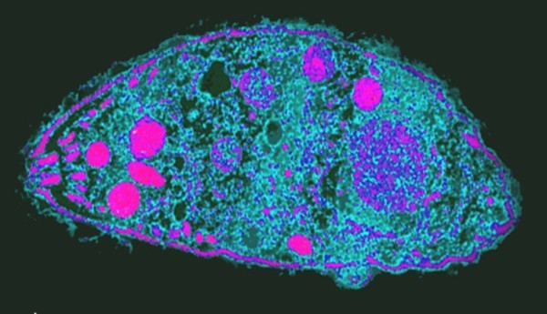 Ký sinh trùng Toxoplasma gondii