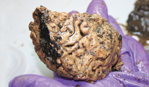 Phát hiện não người được bảo quản trong lớp bùn suốt 2.600 năm