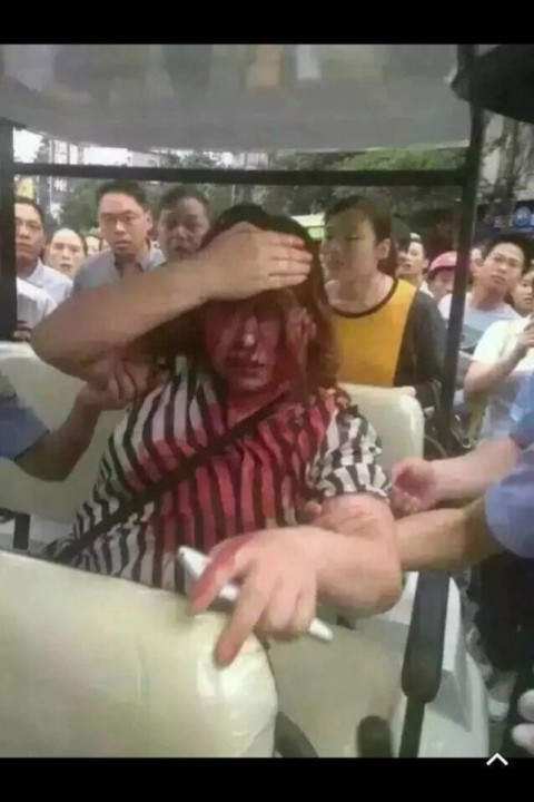 Một phụ nữ bị thương trong vụ trấn áp của cảnh sát chống bạo động tại huyện Lân Thủy, ngày 17 tháng 5 năm 2015 (ảnh: Sina)