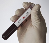 gloved hand holding test tube with blood sample  and label indicating HIV negative test result