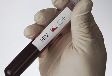 gloved hand holding test tube with blood sample  and label indicating HIV negative test result