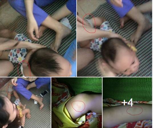 Hình ảnh Bé trai 14 tháng bị 3 cô giáo bạo hành: Mẹ đau đớn đến quặn thắt số 1