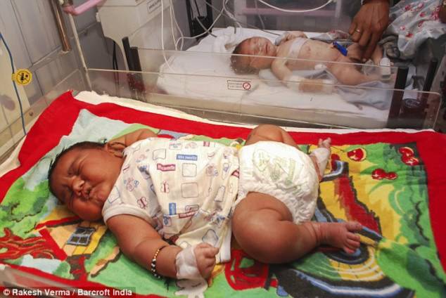 Hình ảnh Kỷ lục em bé sơ sinh nặng gần 6kg ở Ấn Độ số 1