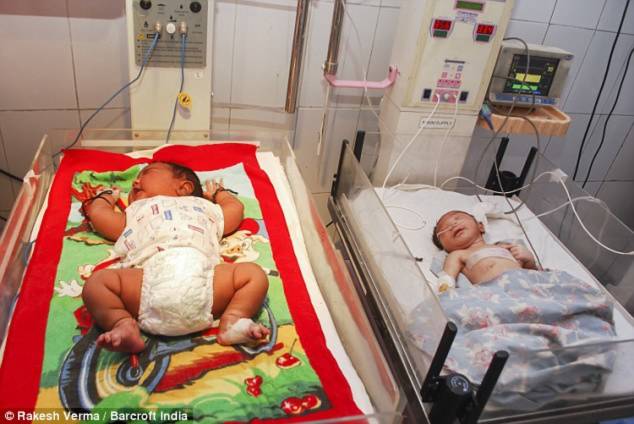 Hình ảnh Kỷ lục em bé sơ sinh nặng gần 6kg ở Ấn Độ số 2