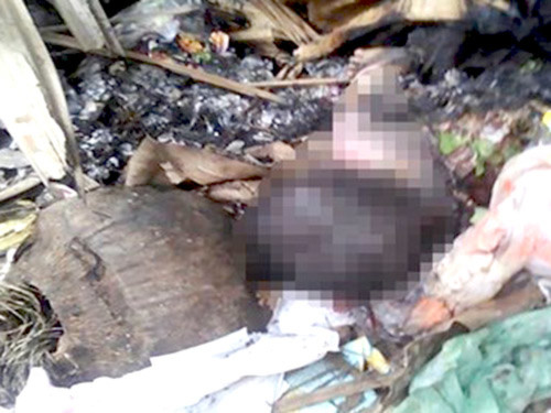 Thắt lòng vụ bé sơ sinh bị mẹ đốt ở bãi rác - 1
