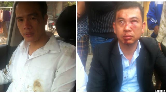 Luật sư Trần Thu Nam (phải) và Luật sư Lê Văn Luân sau khi bị hành hung. Vụ việc xảy ra hôm 3/11 khi luật sư Nam và Luân tới nhà bà Đỗ Thị Mai, mẹ của thiếu niên Đỗ Đăng Dư, người đã bị tử vong trong lúc bị giam giữ.