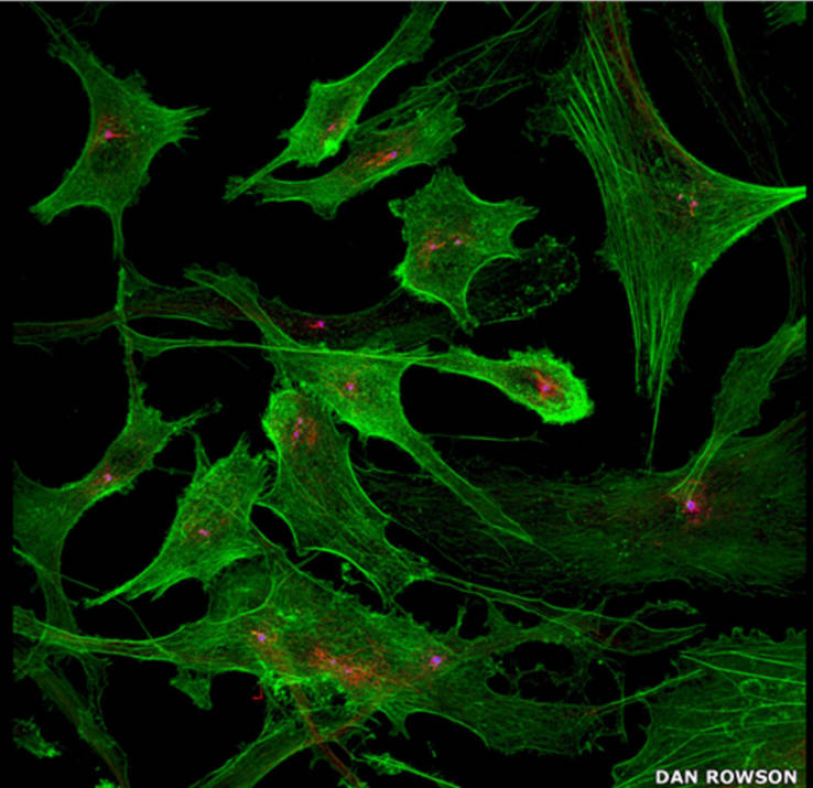 Dan Rowson tham gia với ảnh chụp tế bào oenocytes ở người được nhuộm màu bằng actin (xanh lá cây), acetlyated tubulin (đỏ) và basal body (đỏ tươi).