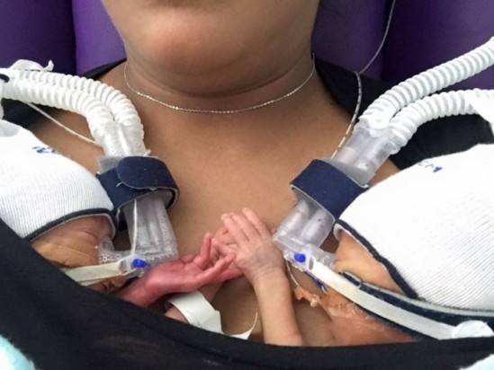 premature-birth-twins-hold-hands-babies-anthea-jackson-rushford-2