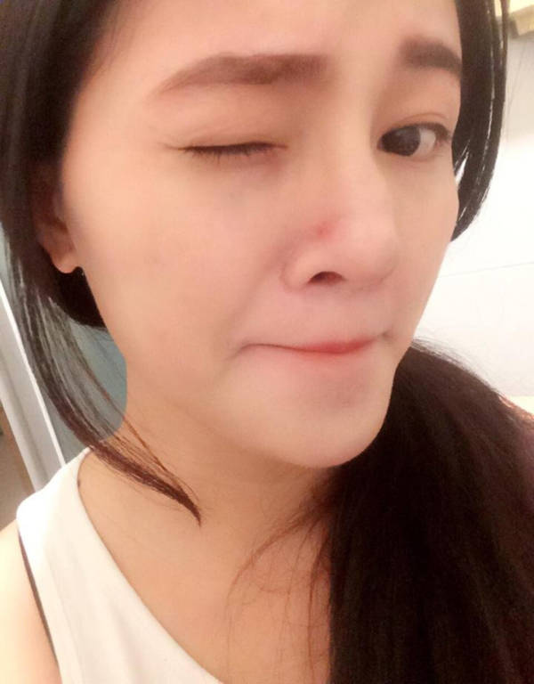 Những bạn trẻ đã và đang rước họa vào thân vì ham phẫu thuật thẩm mỹ - Ảnh 8. Những bạn trẻ đã và đang rước họa vào thân vì ham phẫu thuật thẩm mỹ - Ảnh 8.