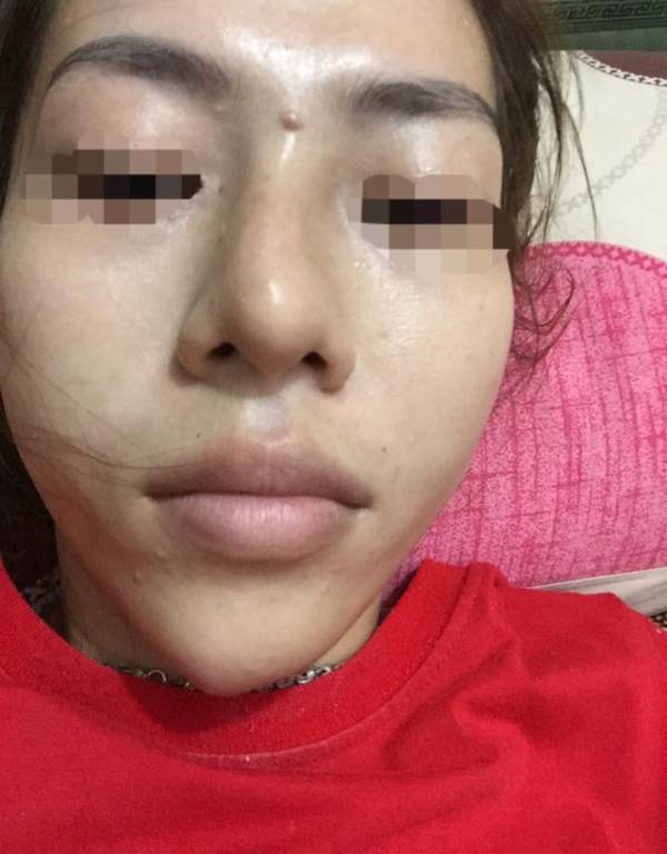 Những bạn trẻ đã và đang rước họa vào thân vì ham phẫu thuật thẩm mỹ - Ảnh 10. Những bạn trẻ đã và đang rước họa vào thân vì ham phẫu thuật thẩm mỹ - Ảnh 10.