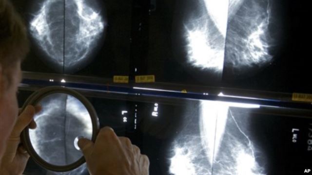 Chuyên gia chẩn đoán hình ảnh sử dụng kính lúp để kiểm tra phim chụp X-quang cho bệnh nhân ung thư vú ở Los Angeles.