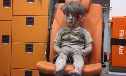 Cậu bé Omran Daqneesh ngồi đờ đẫn trên xe cứu thương sau khi được giải cứu từ một ngôi nhà sập ở Aleppo, Syria. Ảnh: AMC