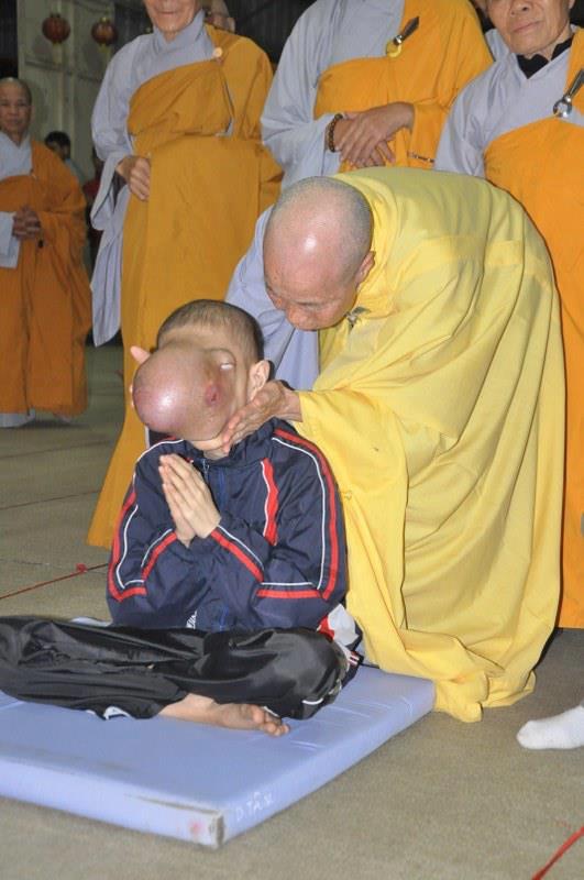 Khuôn mặt cậu bé với các đặc điểm đáng sợ là quả báo của nghiệp sát quá nặng cậu bé đã tích trong các đời trước…